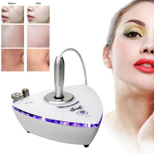 Winkle Removal Beauty Facial Beauty Machine Radio Skin Frequency 3 in 1